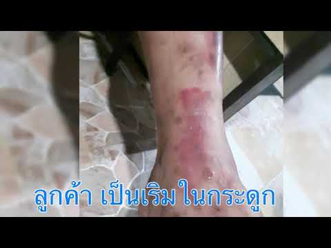 คลิกเพื่อดูคลิปวิดีโอ