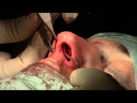 download lagu mp3 mp4 Cerrada, download mp3 Cerrada free download, download mp3 Cerrada