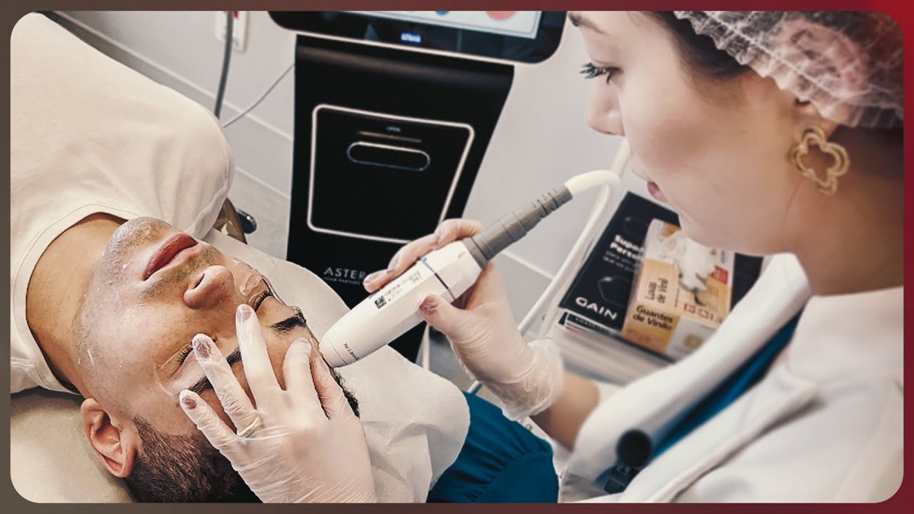 Procedimentos estéticos  | Meu marido resolveu fazer LIFTERA e toxina botulínica | Veja como ficou!