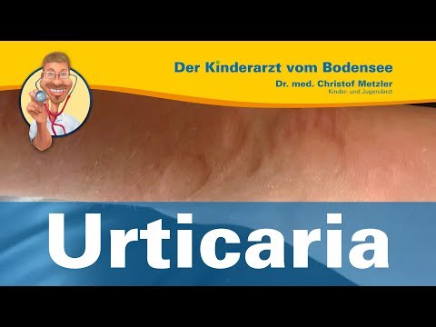 Urticaria - Der Kinderarzt vom Bodensee