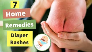 How To Treat Baby Diaper Rashes Fast At Home | 7 Best Natural Home Remedies For Baby Diaper Rashes