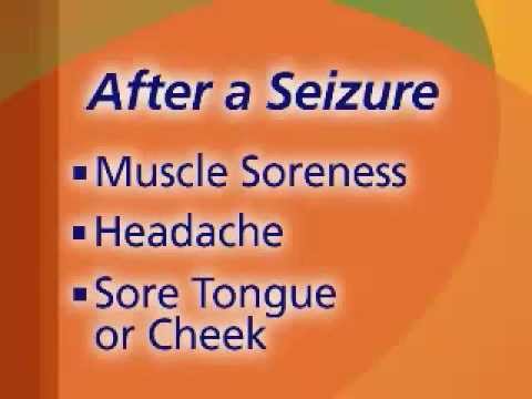 After the Seizure