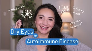 Is it allergies or Lupus? What you need to know about your dry eye and autoimmune condition