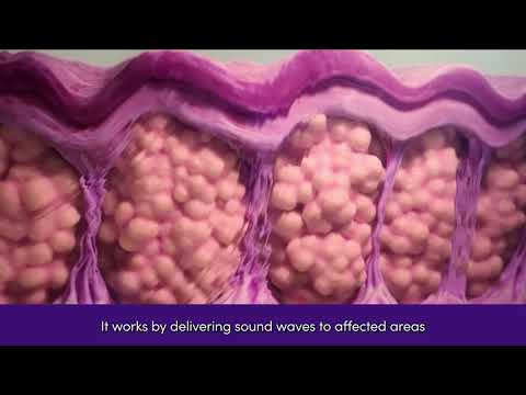 RESONIC™ | Cellulite Treatment | How it Works