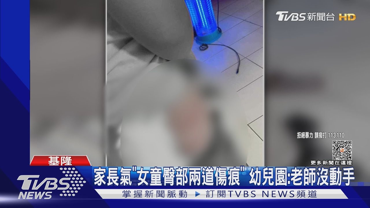 家長氣「女童臀部兩道傷痕」 幼兒園:老師沒動手