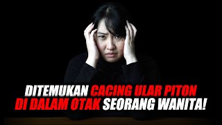 Download lagu CACING ULAR PITON DI DALAM OTAK. mp3 Download lagu CACING ULAR PITON DI DALAM OTAK. mp3