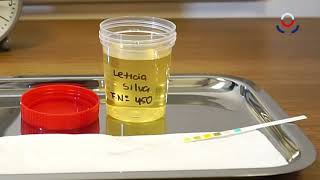 Correcto modo de realizar análisis de orina usando tiras reactivas