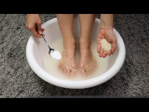 A solution that works wonders for swelling and joint pain - The best remedy for swelling in the legs