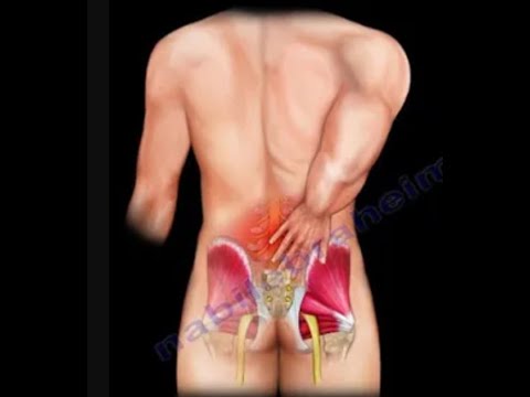 Dolor lumbar: causas, diagnóstico y remedios