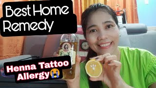 HOME REMEDY SOLUTION FOR HENNA TATTOO ALLERGY