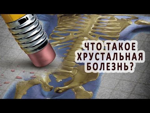 Код остеохондроза шеи по мкб 10 Остеохондроз поясничного отдела 4 стадии