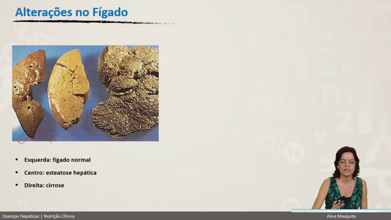 Doenças Hepáticas -  Aula 01