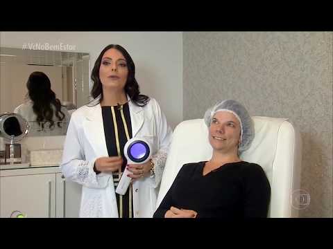 Programa Bem Estar, Rede Globo - Melasma e seus tratamentos com Dra. Luciane Bravi Hübner