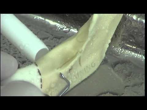 Hüftgelenk und Knorpel Gemeinsame Interpunktion