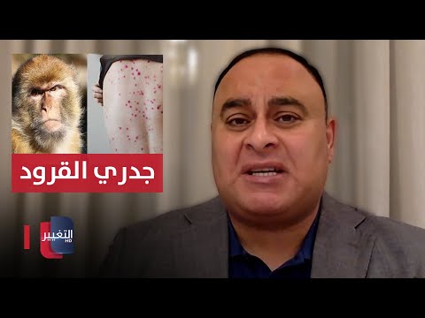شاهد بالفيديو.. جدري القردة طرق العدوى كيفية انتقاله الى البشر
