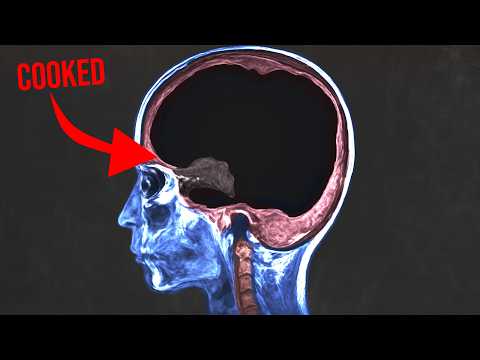 A man asked AI for health advice and it cooked every brain cell