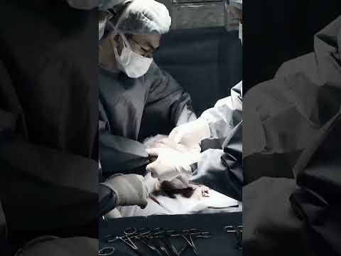 Sinh mổ ngôi ngược 