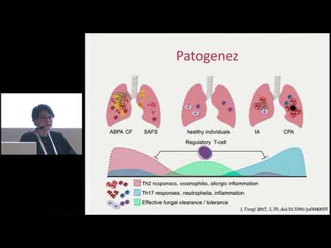 34 aspergillus enfeksiyonlari