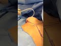 Filling An Implant Sizer Shorts