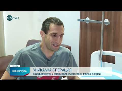 Екипът на д-р Асен Келчев оперира сърце през малък разрез Екипът на д-р Асен Келчев оперира сърце през малък разрез