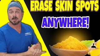 This Can Erase Dark Skin Spots Anywhere! | Chris Gibson