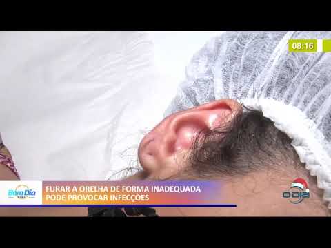 Furar a orelha de forma inadequada pode provocar infecções 16 12 2020