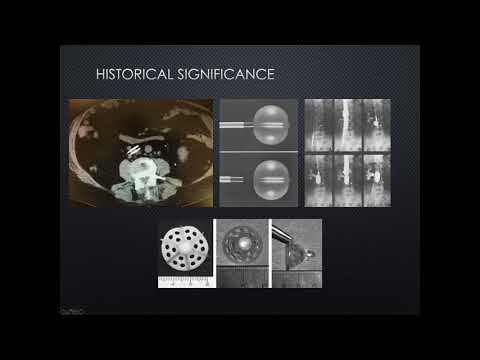 SIR-RFS Webinar (8/22/2018): Introduction to IVC Filters - Placement and Retrieval Techniques