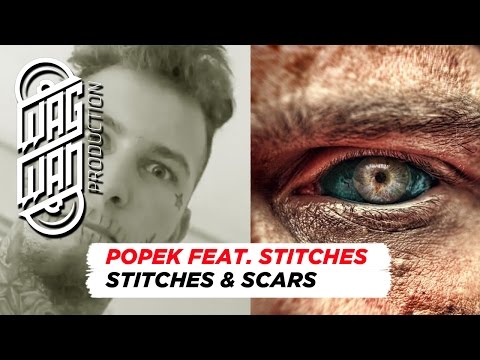 Video thumbnail for Stitches & Scars
