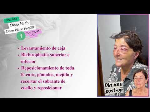 Alfonso Ramírez Aranda-63