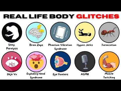 Every Real-Life Body Glitch Explained in 8 Minutes