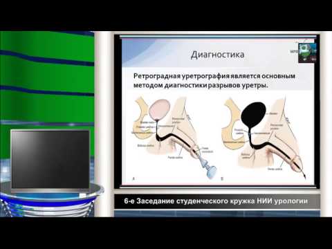 Печеркин А А - Повреждение уретры