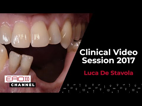 Luca De Stavola / Clinical Video Session 2017
