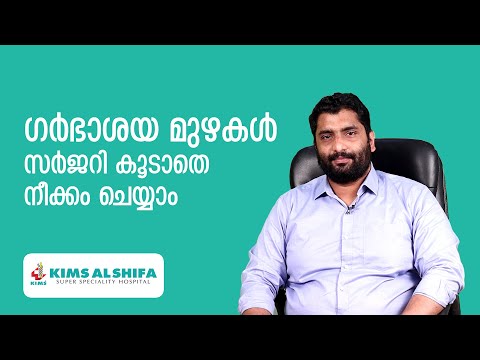 ഗര്ഭാശയ മുഴകള് സർജറി കൂടാതെ നീക്കം ചെയ്യാം | KIMS Alshifa Peinthalmanna