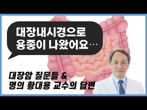 대장내시경으로 용종이 나왔어요. 대장암이 되나요? 대장암 질문들과 명의 황대용 교수의 답변