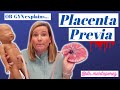 Placenta Previa? A cause of bleeding in pregnancy | OBGYN explains what it means & why it matters