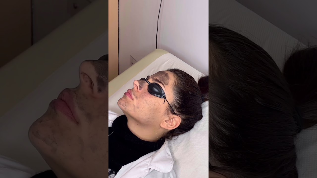 Piergiorgio Turco-38