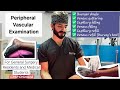 Peripheral Vascular Examination Examination Of Ischemic Limb Dr Tayyab Riaz Ch