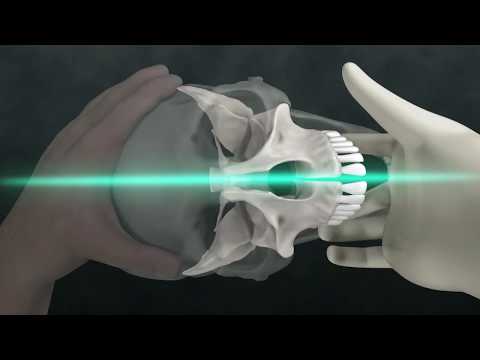 Lyons Institute - Biodynamic Craniosacral Therapy: The Hard Palate - Preview