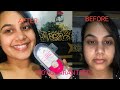 Review Usage And Result Of Globous Face Wash Get Problems Free Skin