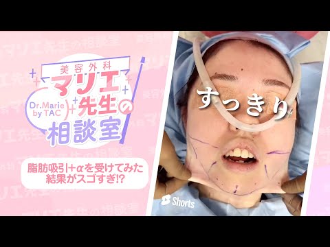 【銀座TAクリニック】マリエ先生の劇的小顔術