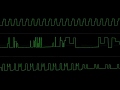 Atari ST Cube Bullet Sequence Oscilloscope View