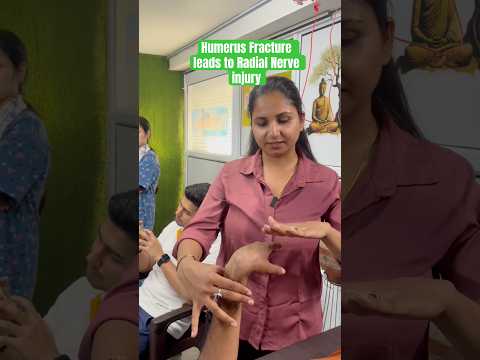 Humerus Fracture Leads to Radial Nerve Injury 😨 | आसान Explanation हिंदी में