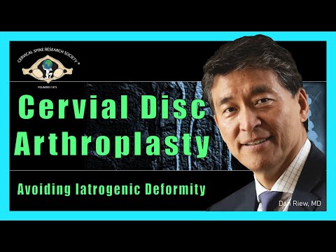 Cervical Disc Arthroplasty:  Avoiding Iatrogenic Deformity