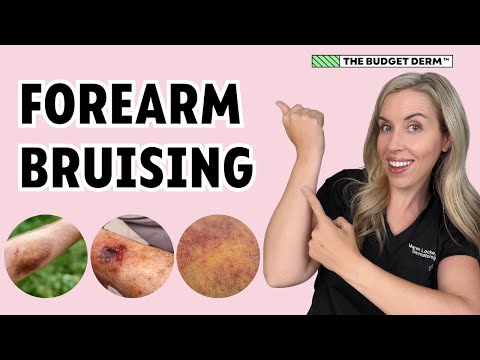 Prevent Forearm Bruising | Aging Tip!