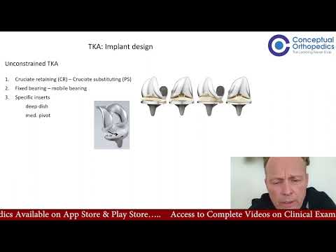 TKA and UKA Indications and Implant Designs by Prof. Dr. Heiko Graichen