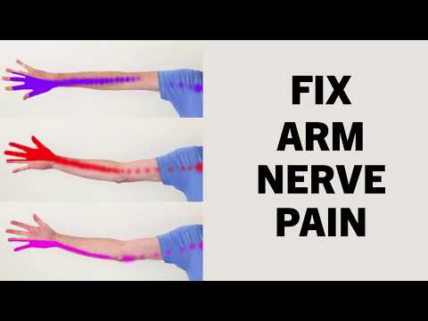 3 Exercise To Relieve Arm Pain, Numbness, Pins and Needles