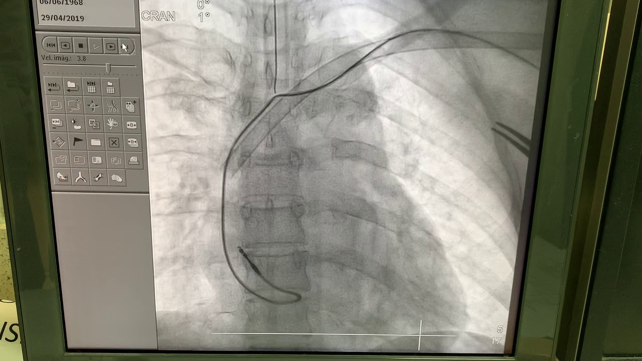 Karim Yarek Juarez Escobar-16