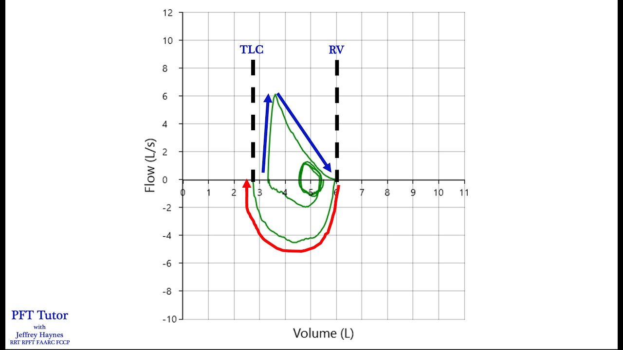 Submaximal Inhalation Error During Spirometry Testing