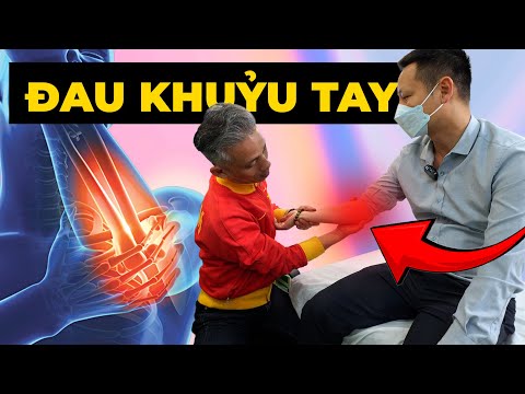 Đau Khuỷu Tay 2 Năm Không Khỏi? Đây Là Lý Do Bạn Điều Trị SAI Cách