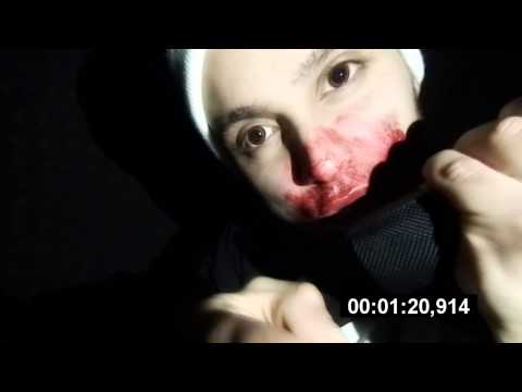 CESCO - "Bzäh Dikka" (Official Video)